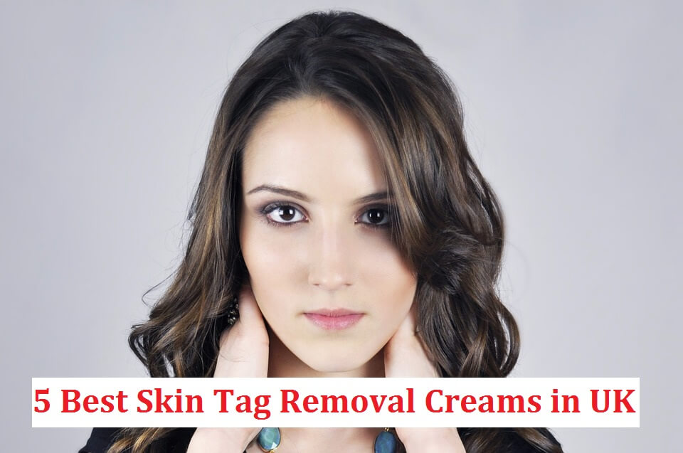 skin tag removal cream uk