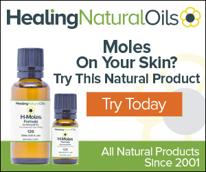 H-Moles Formula Mole Removal