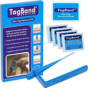 TagBand Mole removal device