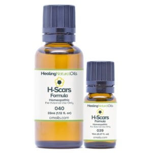 h scars formula