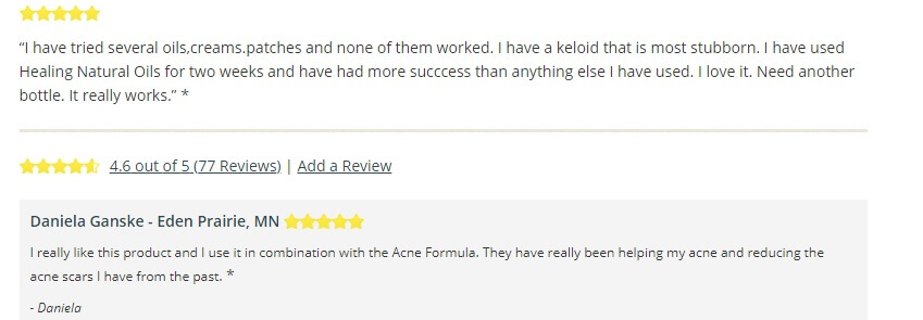 h scars formula customer reviews