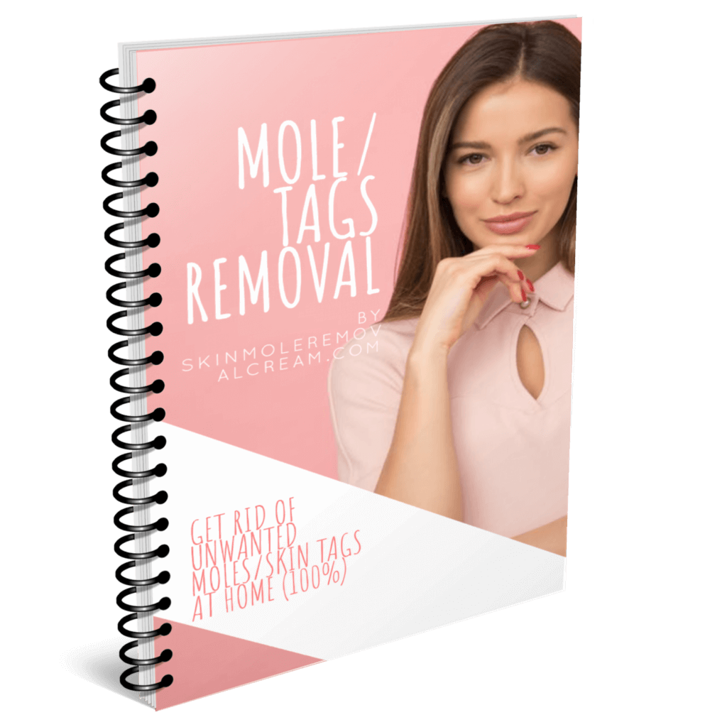 remove moles and tags ebook